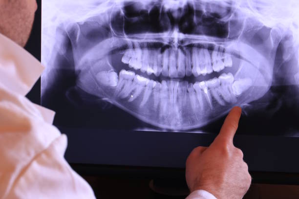 Best Orthodontic Emergency Dentist in Monteagle, TN